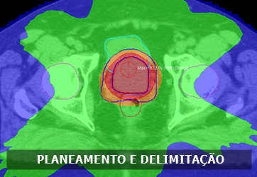 2 planeamento delimitacao red menu 1