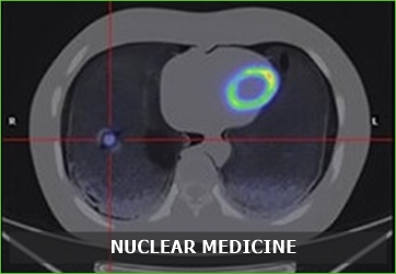 5 medicina nuclear menu 1 ing