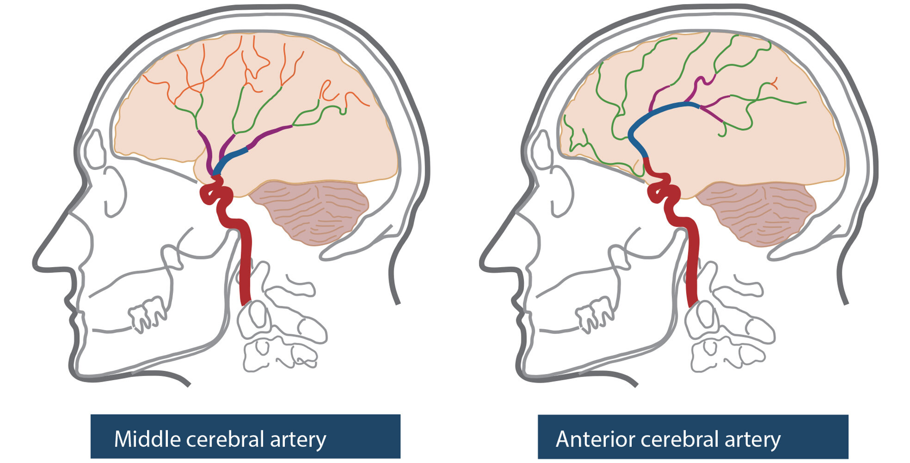 Comp cerebral artery