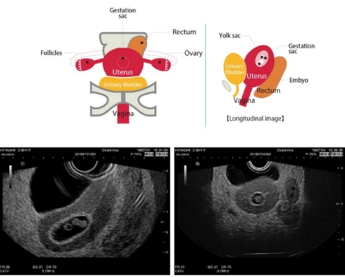 Fantoma de pelvis Feminina para Ultrassonografia 3